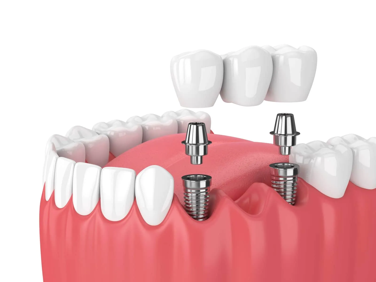 dentist-sheboygan-12