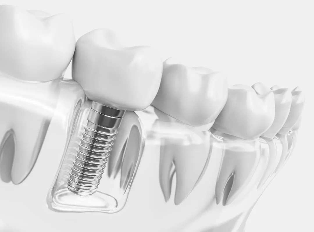 dentist-sheboygan-13