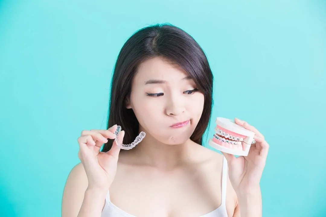 Clear Aligners