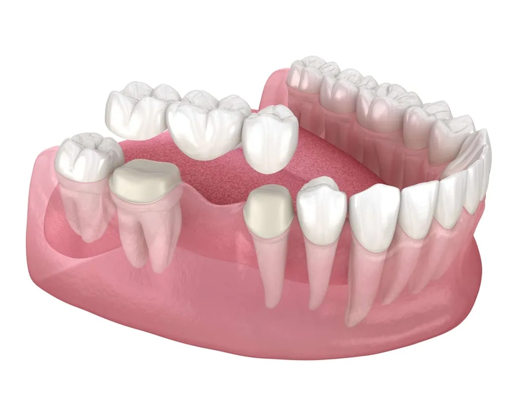 dentist-sheboygan-bridges-03