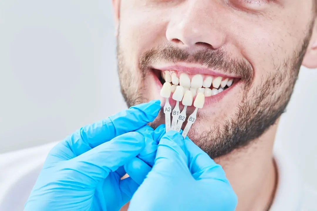 dentist-sheboygan-porcelain-01