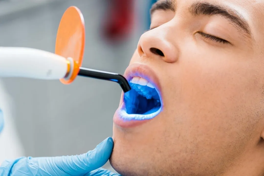 dentist-sheboygan-teeth-sealnts-03
