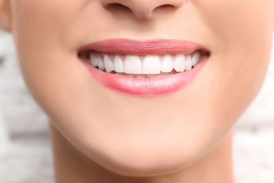 dentist-sheboygan-teeth-whitening-01